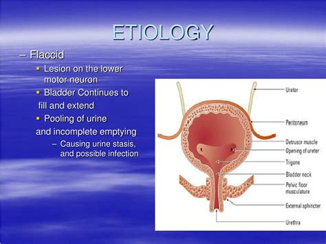 PPT - Neurogenic bladder PowerPoint Presentation, free download - ID:834467