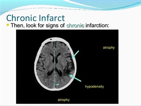 Approach to head ct