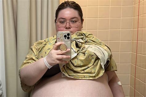 Florida Woman, 20, Has 100-Lb. Ovarian Cyst Removed