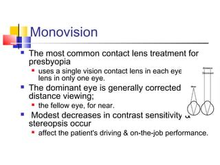 Presbyopic Contact Lenses: Bifocals and Multifocals | PPT