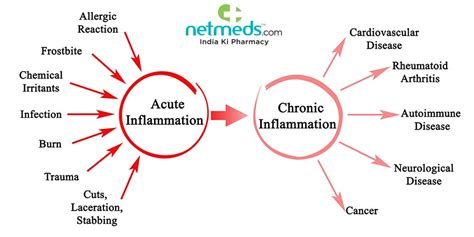 Inflammation: Types, Causes, Symptoms And Treatment