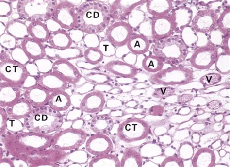 Histology - Identify the Structures Found Within the Nephron ...