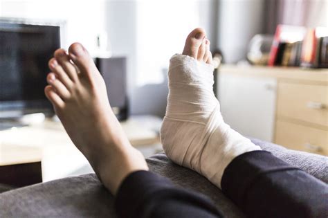 Tips for Boosting Your Recovery After Ankle Surgery - Thomas A. McDonald, MD FAAOS