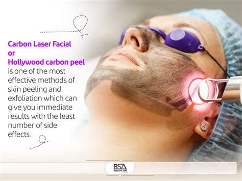 Carbon Laser Facial Before and After