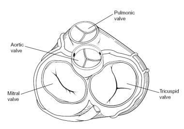 Pulmonic Valve Anatomy: Overview, Pathophysiologic Variants