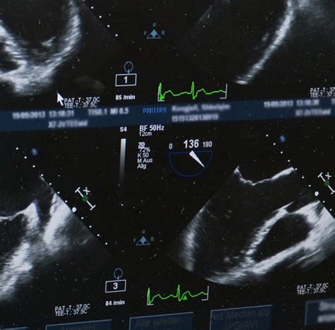 Ultrasound / Sonogram Archives - Vital Imaging