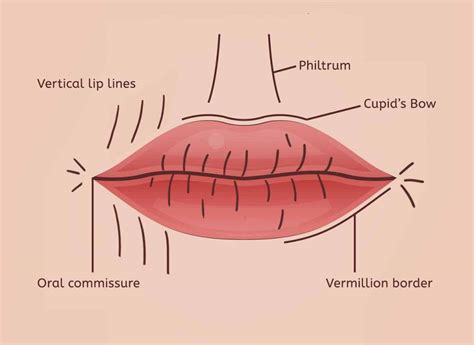 Lip lines treatment options at Castleknock Cosmetic Clinic