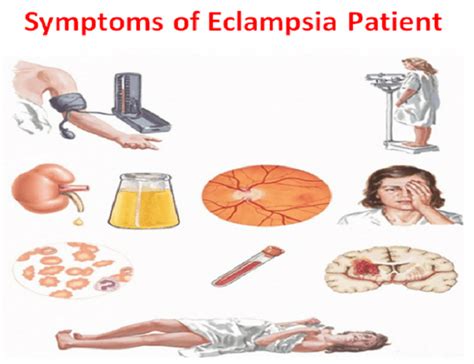 30 Vital Nursing Interventions for Eclampsia Patient