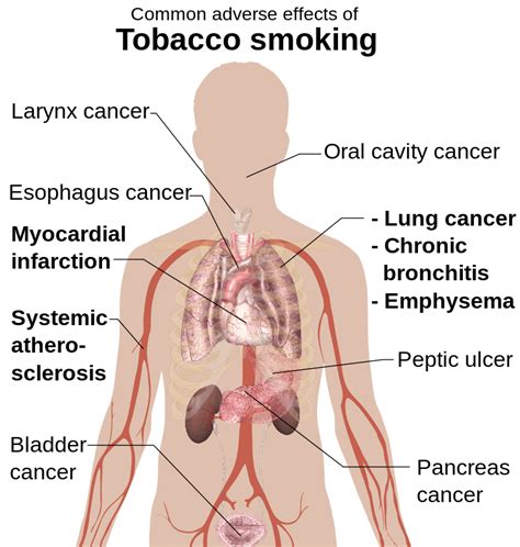 10 Diseases Caused By Smoking - Sutured