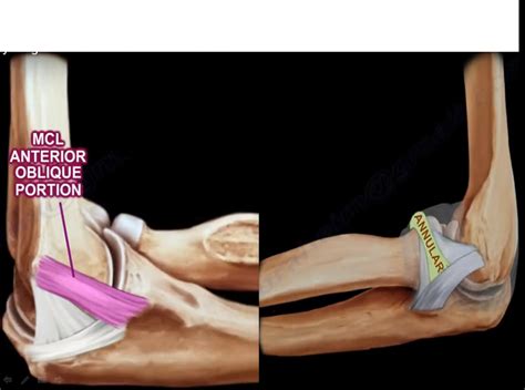 Anatomy of the Ligaments of Elbow — OrthopaedicPrinciples.com