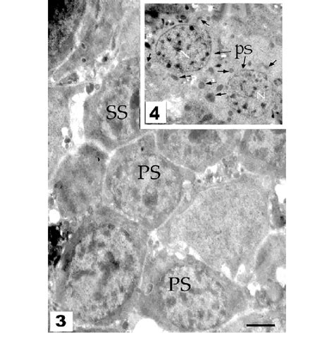 Primary spermatocyte (PS) and secondary spermatocyte (SS) at the ...