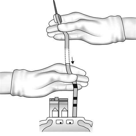 1A Umbilical cord blood collection procedure. Double-clamp the... | Download Scientific Diagram