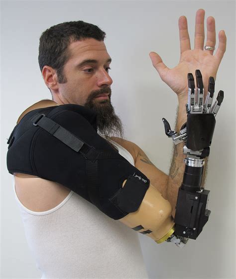 Bionic Arm