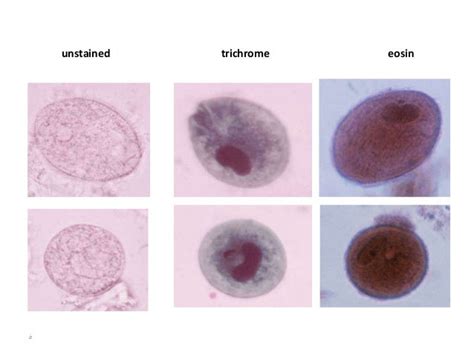 Balantidium coli