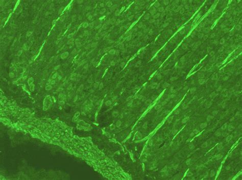 Anti-smooth muscle antibodies (ASMA) positive control - Launch Diagnostics