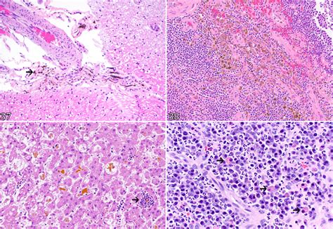 (37) Leptomeningeal melanocytes, brain, cow. Leptomeningeal melanocytes ...