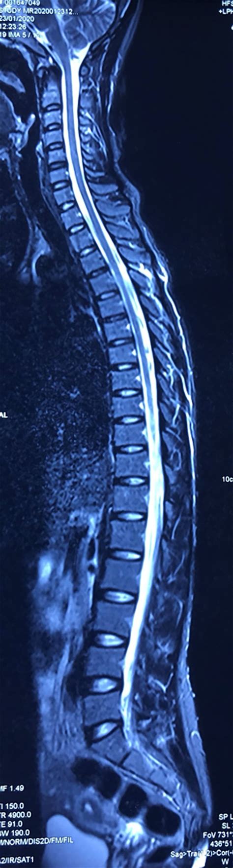 Full-Length Spine CT and MRI in Daily Practice | Radiology Key