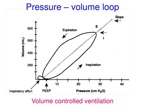 PPT - Interpretation of Ventilator Graphics PowerPoint Presentation - ID:232693