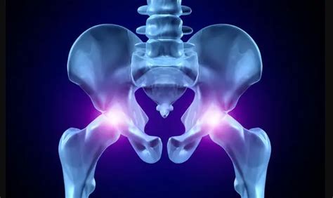 12 Worst Causes of Hip Bone Pain - Body Pain Tips