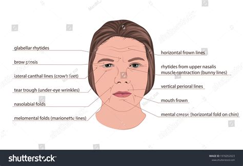 Illustration Different Types Wrinkles Found On Stock Illustration ...