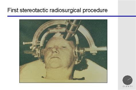 gamma knife, gammaknife, radiosurgery, gamma knife radiosurgery, radiosurgery, stereotactic ...