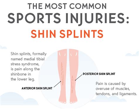 Shin Splints : Types, Causes, Symptoms, Treatment, and Prevention » How To Relief