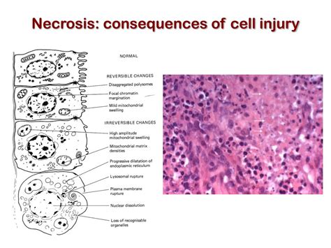 PPT - Mechanisms of Cell Death PowerPoint Presentation, free download - ID:241715