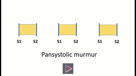 Pansystolic murmur - YouTube