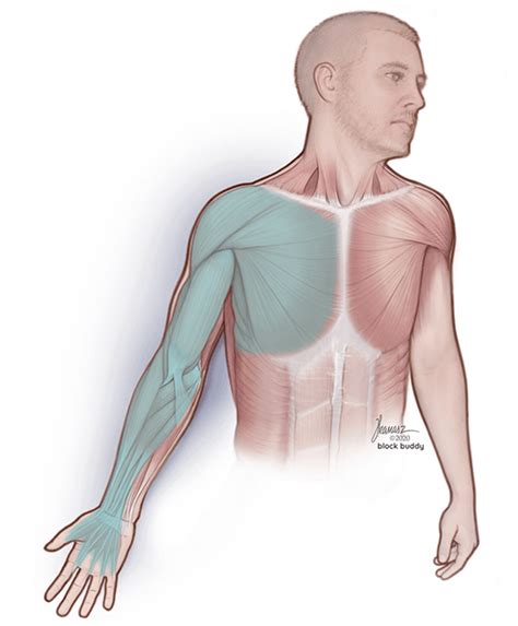 Interscalene Block Ultrasound Guided Technique | Block Buddy