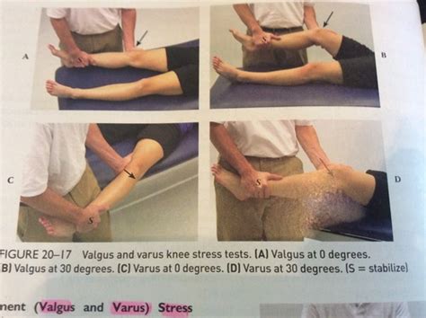 Valgus Stress Test Knee Positive - cloudshareinfo