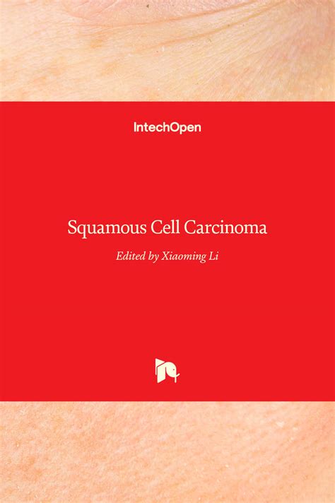 Squamous Cell Carcinoma | IntechOpen