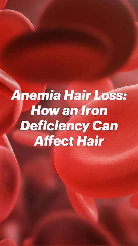 Anemia Hair Loss: How an Iron Deficiency Can Affect Hair
