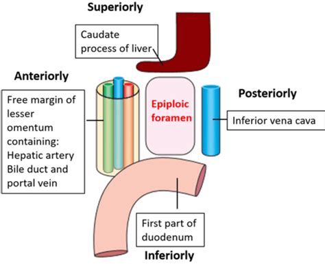 Lesser Sac and Epiploic Foramen , bouundaries and applied aspects , Anatomy QA