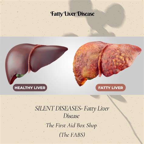 Fatty Liver Disease 101