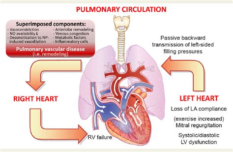 Figure 1 from Left ventricular heart failure and pulmonary hypertension† | Semantic Scholar