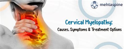 Cervical Myelopathy: Causes, Symptoms & Treatment Options