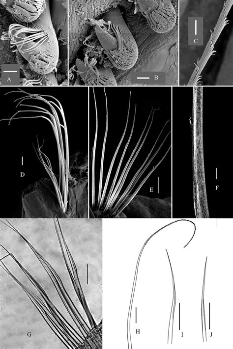 Chaetae of Maldane adunca sp. n. A–B neurochaetae from the 2 nd and 17... | Download Scientific ...