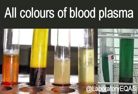 Medical Laboratory and Biomedical Science: All colours of blood plasma