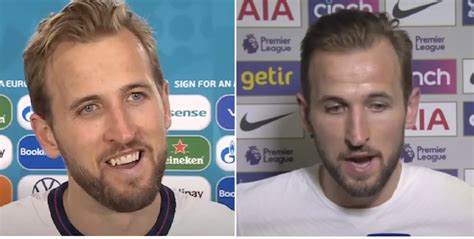 Harry Kane Hair Transplant: Everything You Need To Know