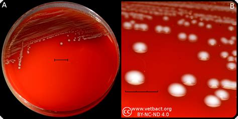 Enterococcus faecium