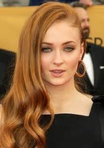 Sophie Turner Plastic Surgery Before and After - Celebrity Surgeries ...