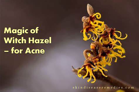 Witch Hazel A Quick Remedy For Acne - Skin Disease Remedies