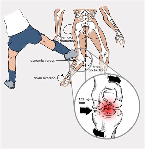 Physiocure | The sports Rehab clinic.