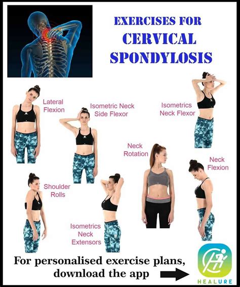 Pin by Marie Machado on Healthy Seniors!!!! | Cervical spondylosis, Workout plan, Exercise