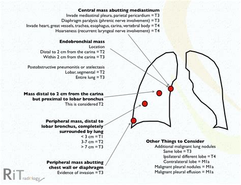 RiT radiology: 2009 Non-Small Cell Lung Cancer Staging System (3)