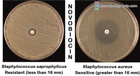 Novobiocin Susceptibility Test - Procedure, Uses and Interpretation