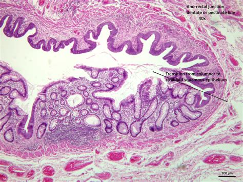 Pectinate Line Histology