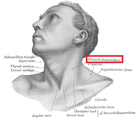 Sternocleidomastoid Muscle | Action, Origin & Insertion - Lesson ...