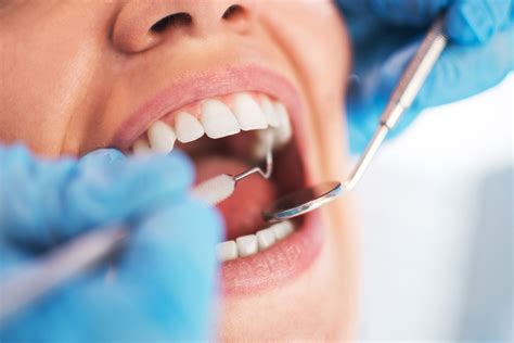 ᐈ What is a Dental Check Up Procedure? | Markham Smile Centre