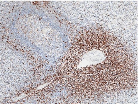 CD5 Antibody (PA5-80437)